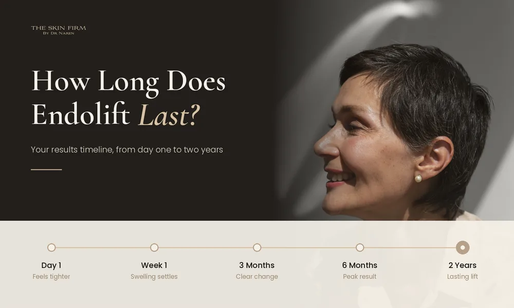 How Long Does Endolift Last? Your Results Timeline