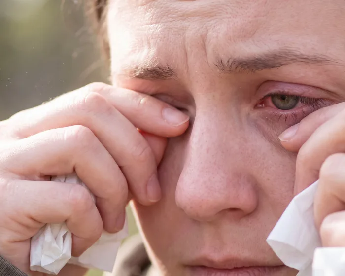 A woman rubbing tired, irritated eyes, a common trigger for dark circles