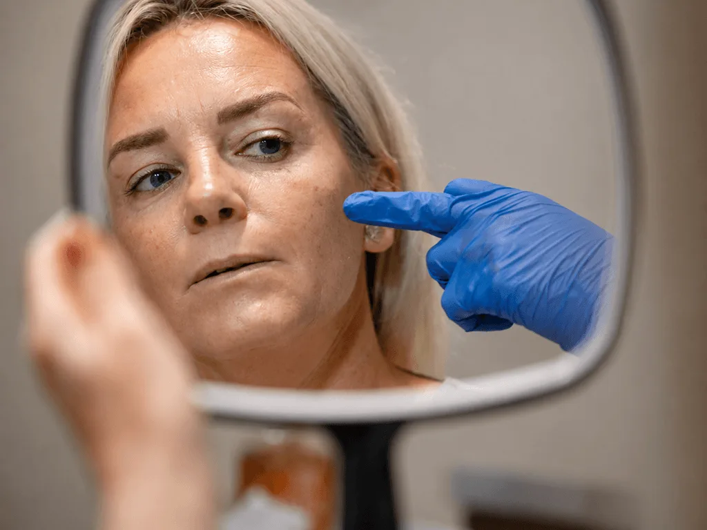 Dermal Filler (Teoxane)