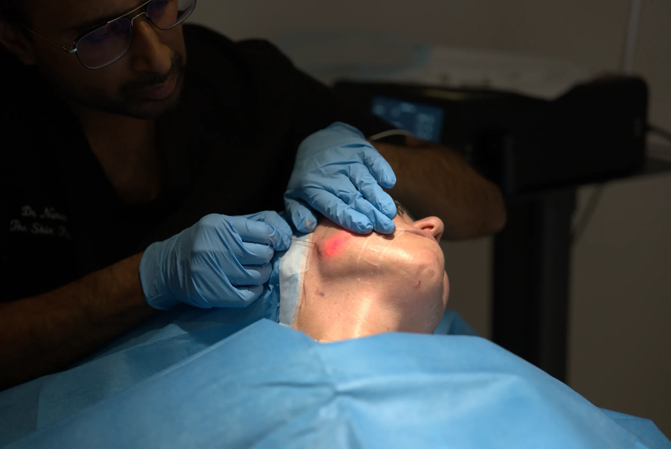 Dr Naren performing Endolift laser treatment at The Skin Firm, Sheffield