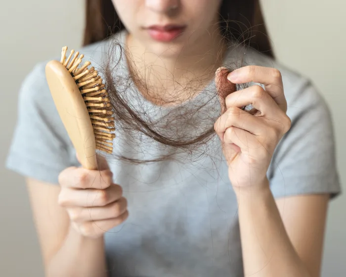 A woman holding a hairbrush with strands of shed hair, a common sign of hair loss