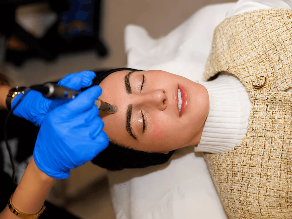 Microneedling