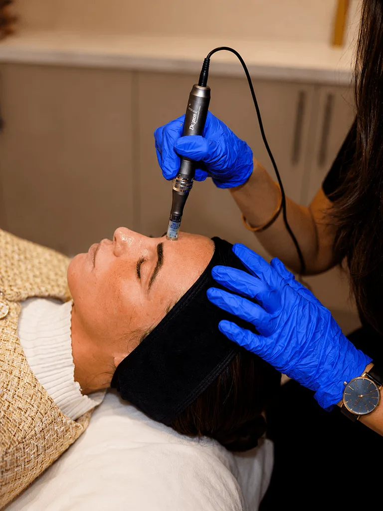 The science behind microneedling at The Skin Firm Sheffield